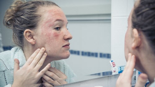 Woman with atopic dermatitis looking at affected skin on her face in a bathroom mirror